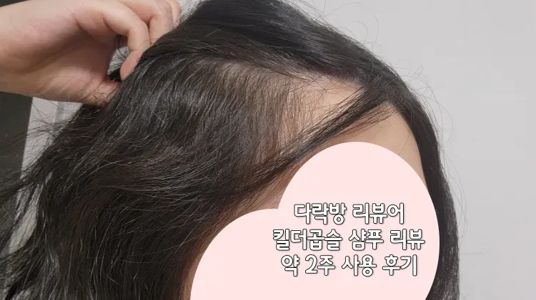 13일차-m자-이마-기준으로-본-곱슬모습